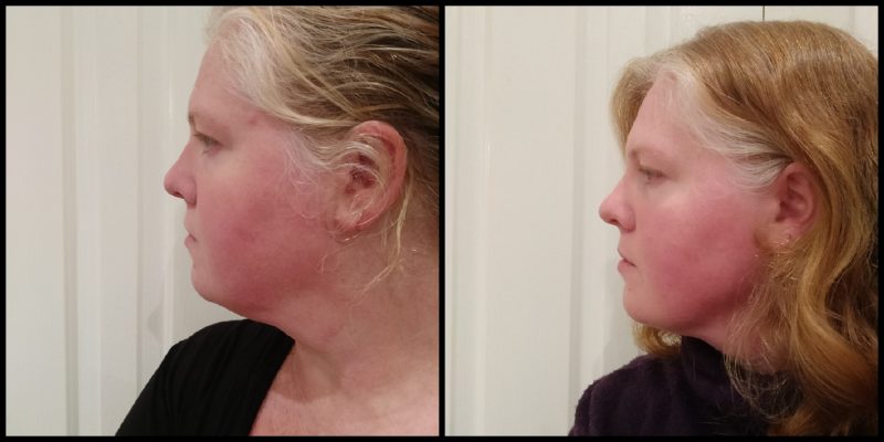 Phase 2 fat loss half way | www.unitywellness.com.au