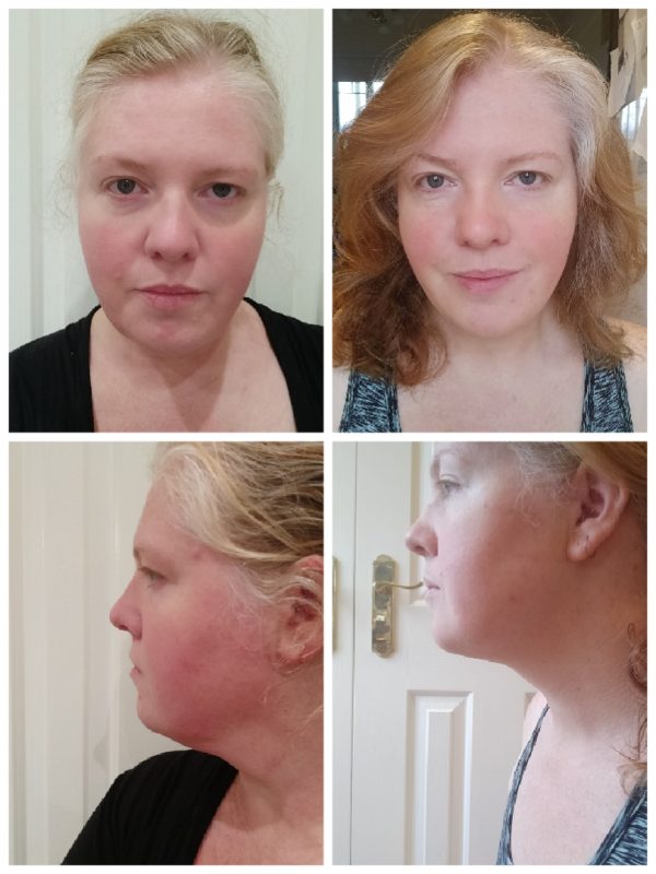 4 Phase Fat Loss Protocol Round 4 | www.unitywellness.com.au